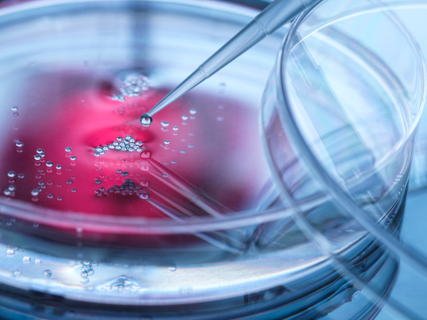 Cell and Gene Therapy Answers: What to know about companion diagnostics development
