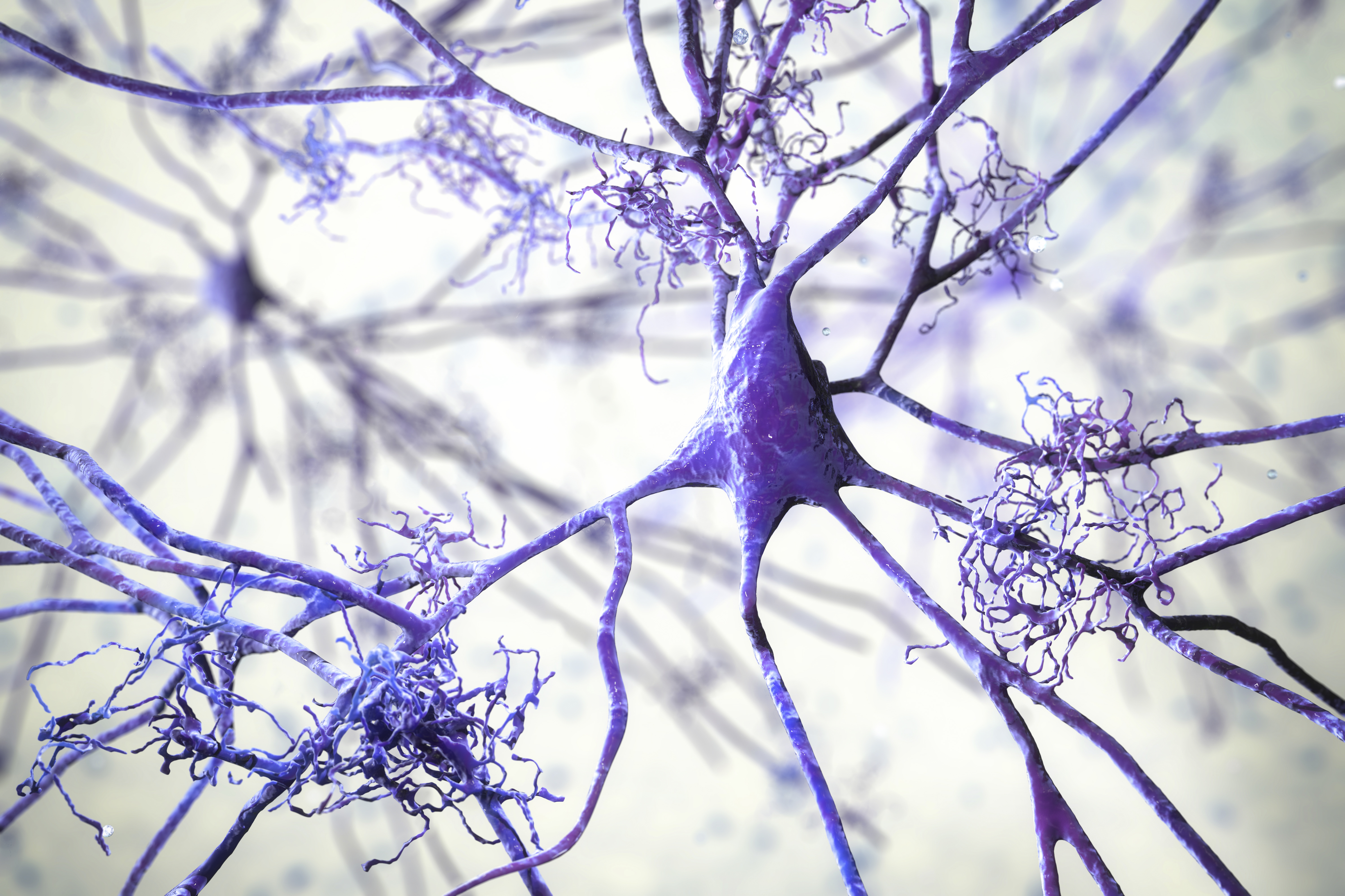 Beyond Alzheimer’s: How Labcorp’s leadership in Alzheimer’s disease testing is guiding work in other neurological diseases