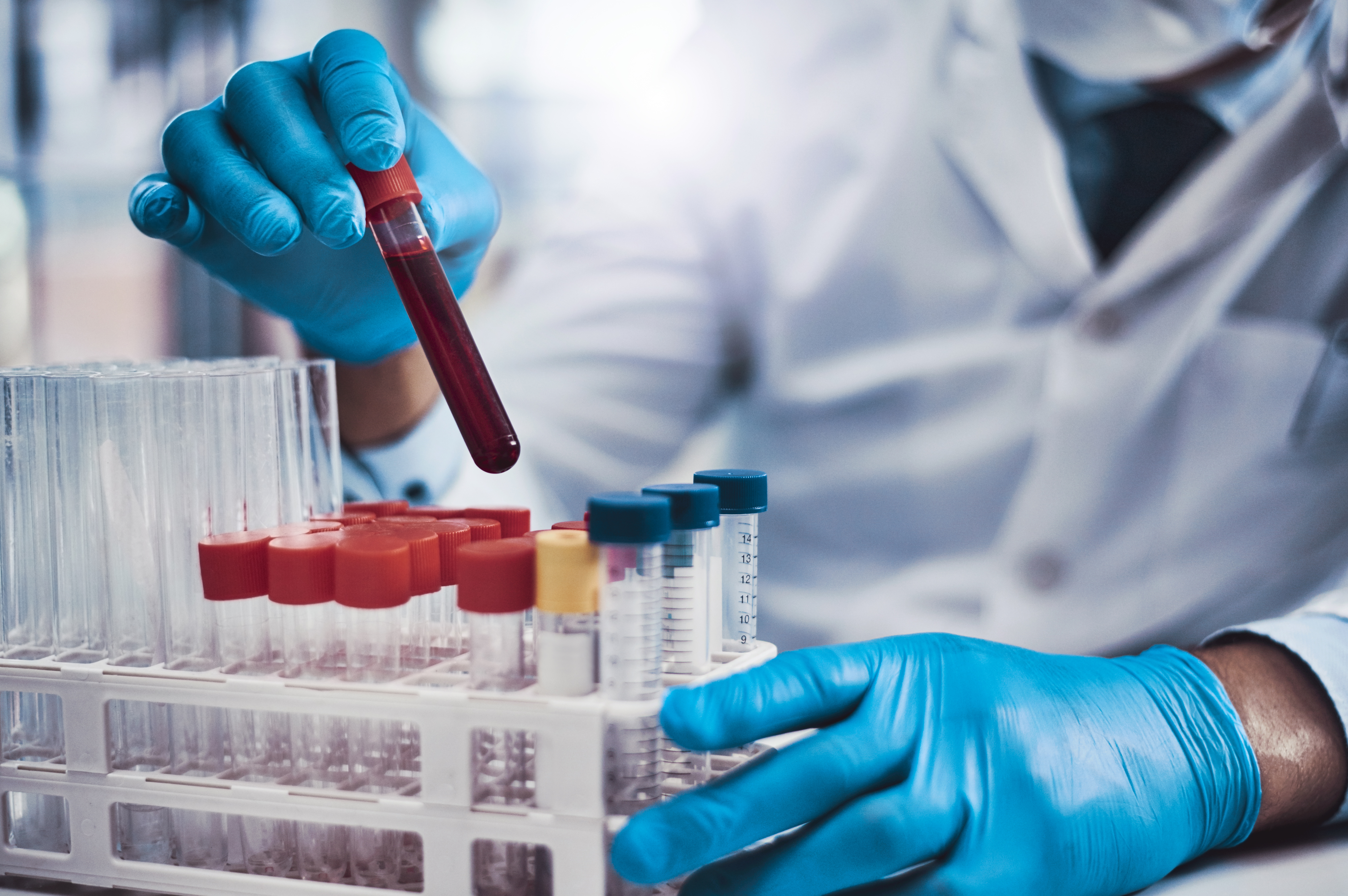 992787324 Cropped shot of an unrecognizable scientist working in a lab